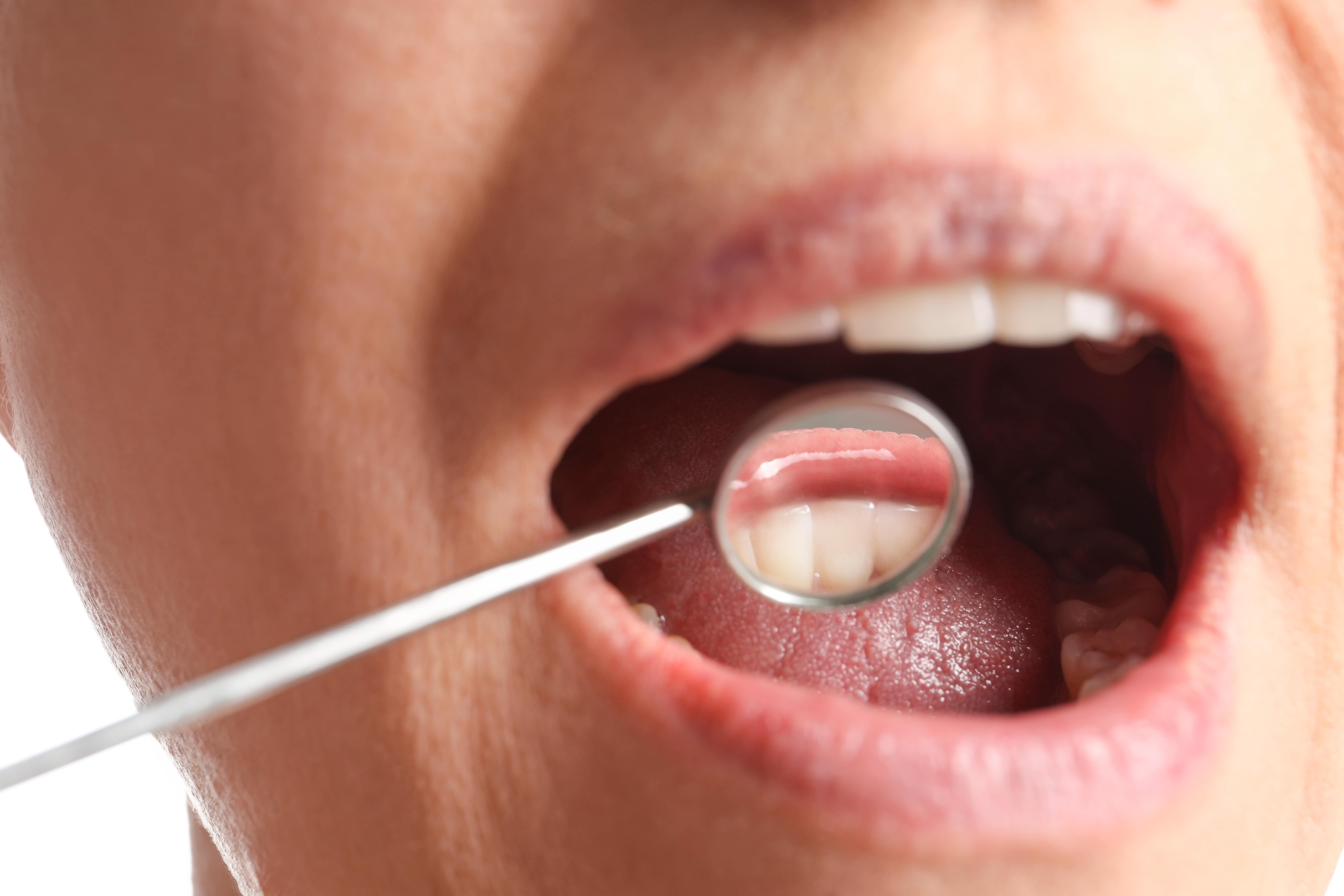 Emergency Dentistry Secaucus NJ