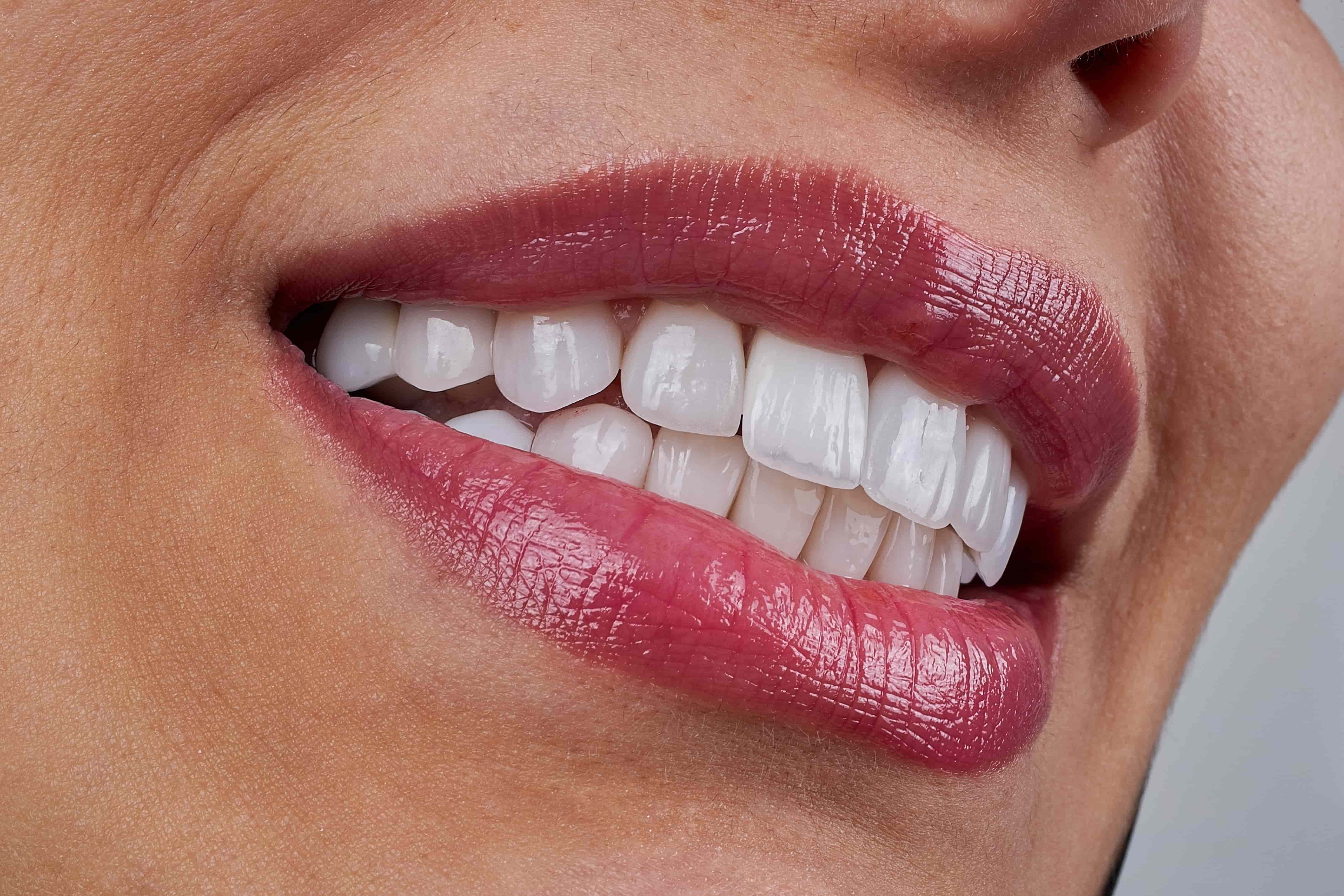Cosmetic Bonding Hoboken NJ