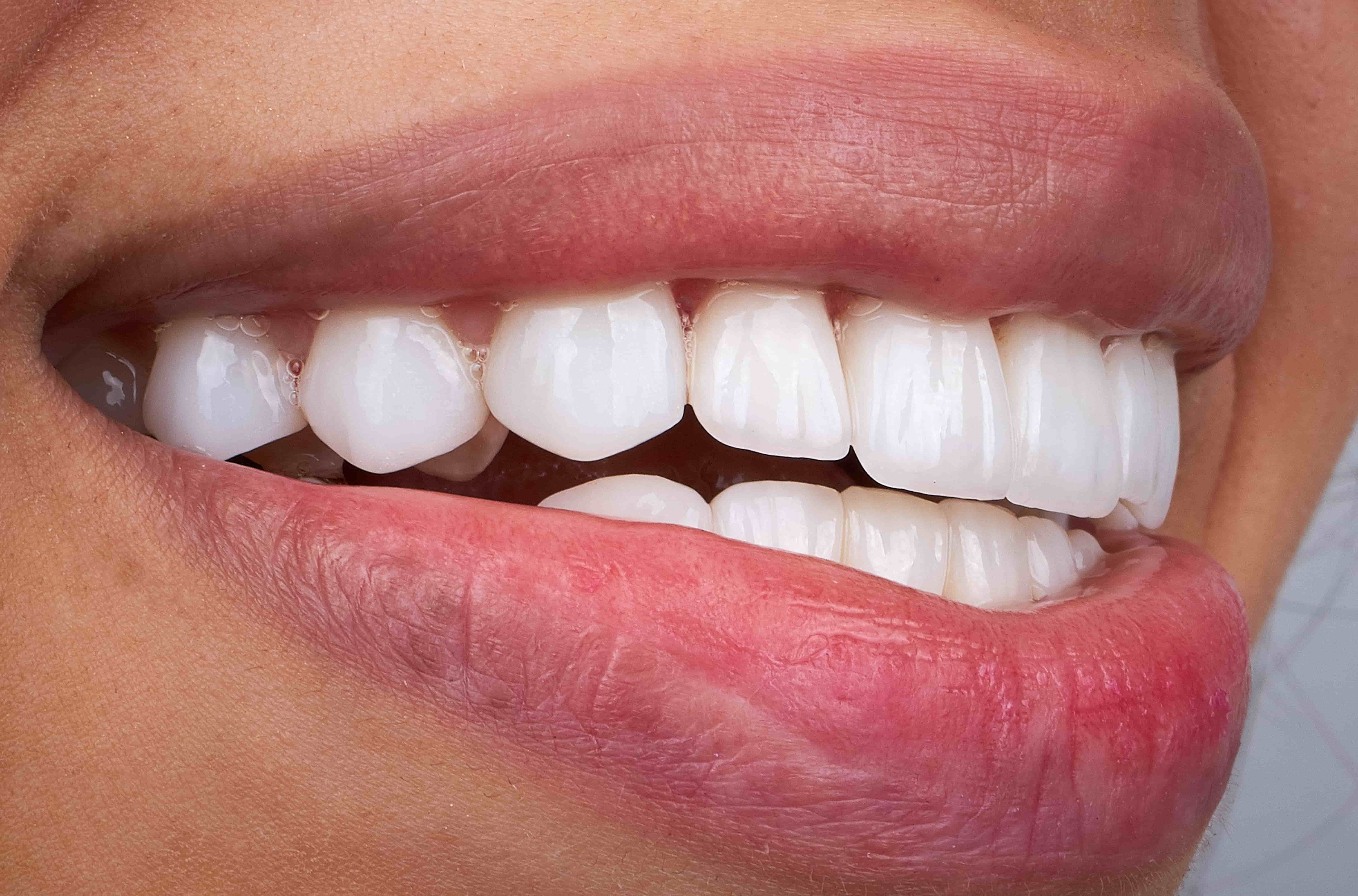 Cosmetic Dentistry Hoboken NJ