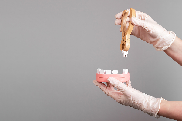 Tooth Extractions New Jersey