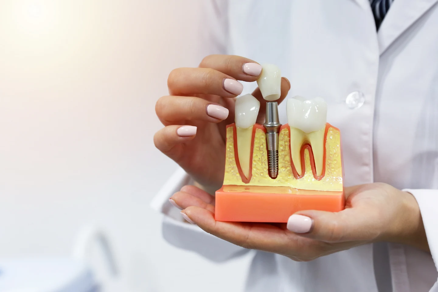 Dental Implants and Diabetes: What You Need to Know