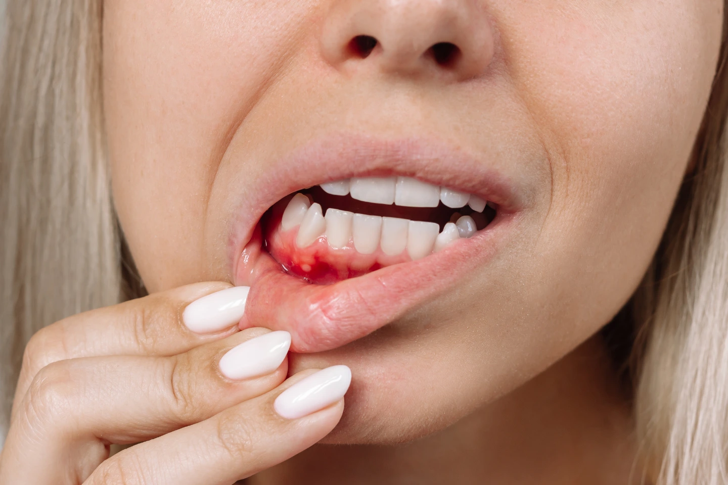 Dental Implants After Gum Disease: Is It Possible?