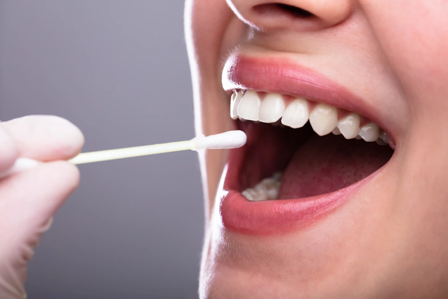 The Role of Saliva in Keeping Your Teeth Healthy