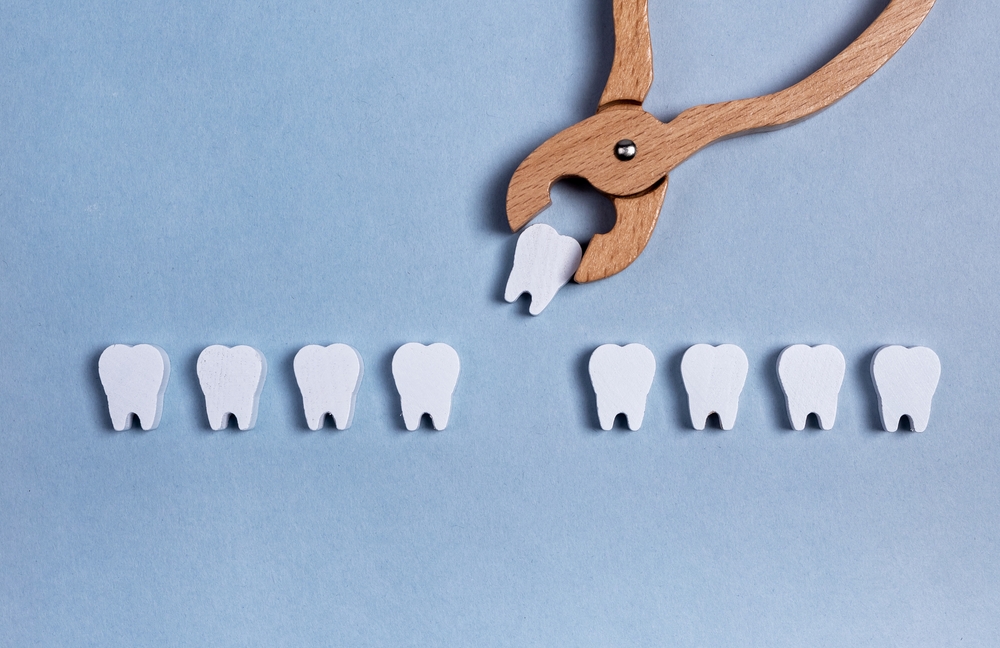 The Process and Benefits of Dental Extractions