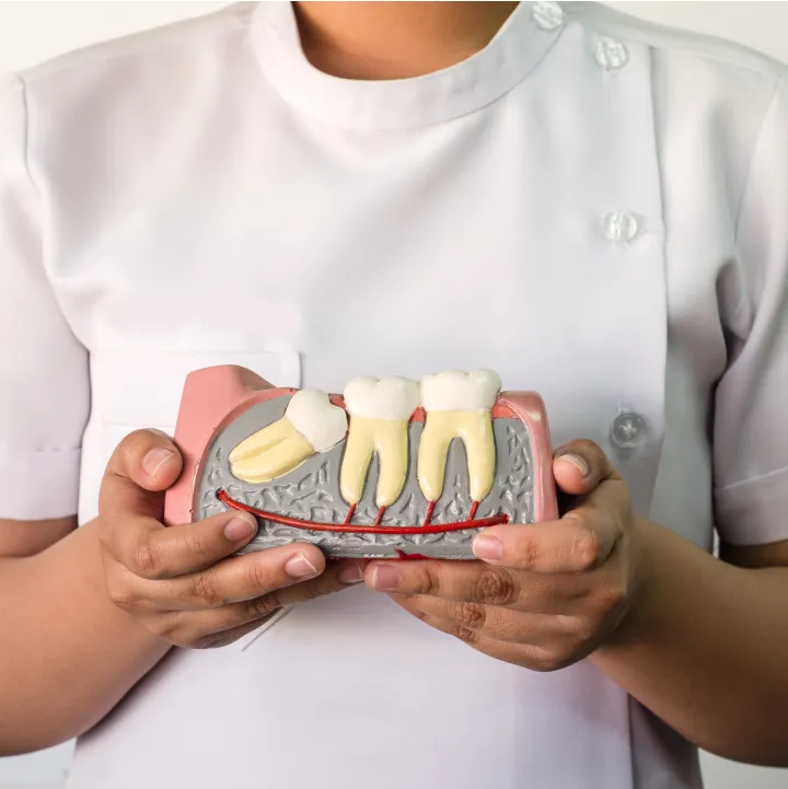 What to Expect When Getting Your Wisdom Tooth Removed